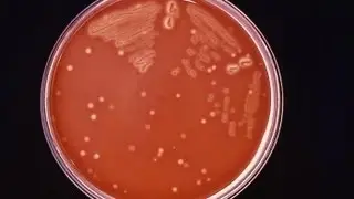 Group A Streptococcus (GAS)