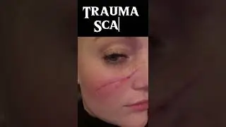 Various aesthetic procedures are done at Da Aesthetic Clinic in Pitam pura Delhi