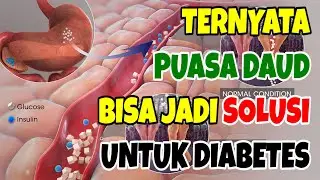 Penderita Kencing Manis Harus Lihat, Ternyata Puasa Daud Bisa Jadi Solusi Penyakit Diabetes