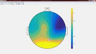 FieldTrip Toolbox  - ERP visualization tutorial (silent)