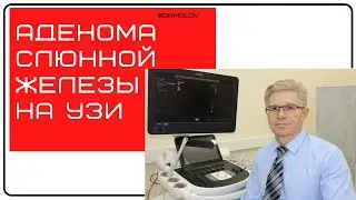 Плеоморфная аденома слюнной железы на УЗИ