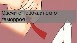 Свечи с новокаином от геморроя