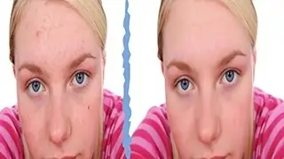Adobe Photoshop - 2 Dakikada Retouch (sivilce kaldırma )