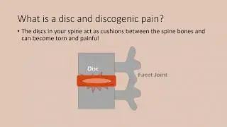 What are Discography Side Effects?