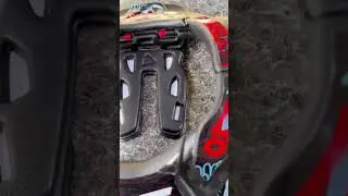 Martin Barr's Fresh Neck Brace!