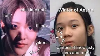 kpop idols before and after plastic surgery | 