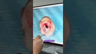 Ранее мы провели конкурс, где угадывали расположение коронки. Рассказываю подробности этого кейса 🙌