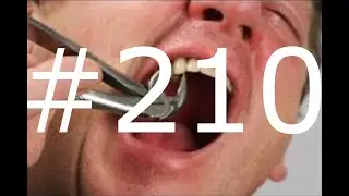 #210 A tooth gone missing