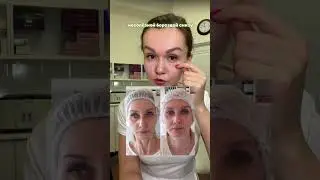 Отвечаю на ваши вопросы (мешки под глазами).