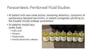 Understanding Ascites and Peritoneal Fluid Analysis