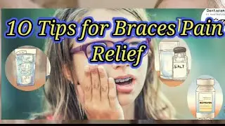 10 tips ब्रेसज का दर्द कैसे हटाएं | how to relief braces pain|
