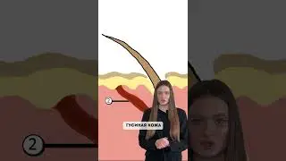 Как избавиться от гусиной кожи Арт. на WB❤️‍🔥 124736264 крем с мочевиной 