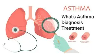 Asthma | Diagnosis |  Treatment