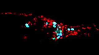 Neurons Moving as C. elegans Eats