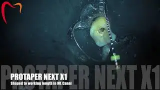 Easy and fast technique for Shaping Canals with Protaper NEXT Rotary Files