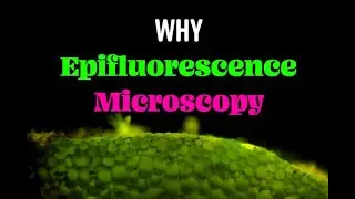 The Power of Epifluorescence Microscopy