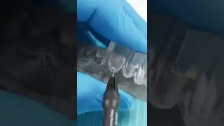 Et non ! Ce n'est pas une Injection de Botox 💉🦷 #shorts #dental #3dprinting #dentist