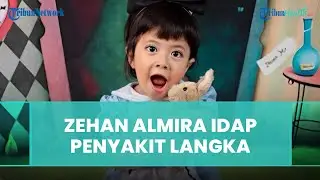 Sosok Zehan Almira Bocah Ceriwis Viral di TikTok, Ternyata Idap Penyakit Langka OI