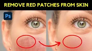 Smooth Skin and Remove Red Patches from an Image - Photoshop Tutorial 