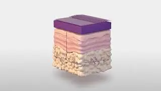 3M™ Prevena™ Plus Customizable dressing application video (abdomen)