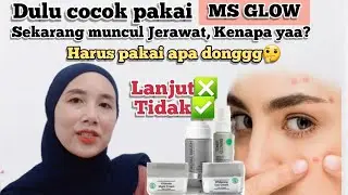 DULU COCOK PAKAI MS GLOW,SEKARANG KELUAR JERAWAT & BRUNTUSAN KENAPA YA???