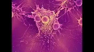 COMMON TYPES OF CANCER