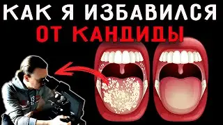 Личный опыт избавления от кандиды.