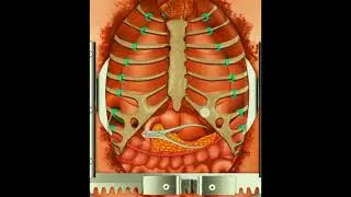 Blood vessels thrombosis laser for remove #bloodvassels #bloodvasselsthrombosis bloodvesselssurgery