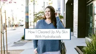 How I Cleared Up My Skin With Hydrafacials