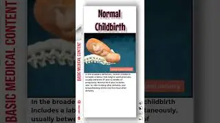 Normal Childbirth 