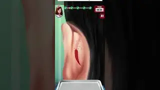 ohs asmr ear surgery #shorts