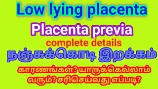 Low lying placenta || placenta previa complete details|| நஞ்சுக்கொடி இறக்கம்
