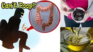 لن تجلس طويلا في المرحاض بعد اليوم علاج الإمساك الشديد وتنظيف القولون سينزل منك مكور أسود أعزكم الله