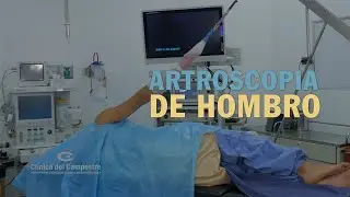 Artroscopia de hombro