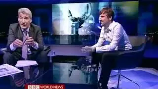 A man decide to amputate his arm and replace it by a bionic