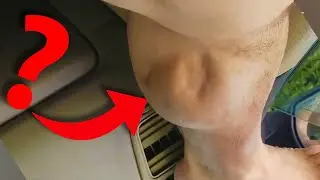 Cosa si nasconde dietro i CRAMPI?