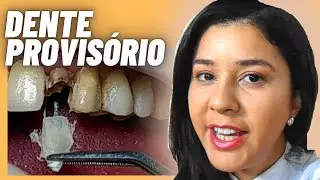 Dente provisório: DESCUBRA como o DENTISTA faz um dente provisório da frente!