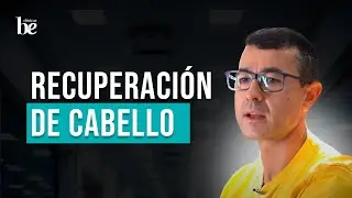 🌟 Sergio Supera su Alopecia con Injerto Capilar en Clínicas Be | Testimonio Real desde Jódar (Jaén)