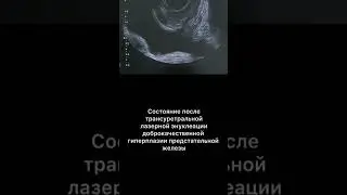 #узи #дгпж #армдиассистент