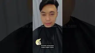 Punya masalah dengan kebotakan dibagian depan? tenang saja hair4all solusinya