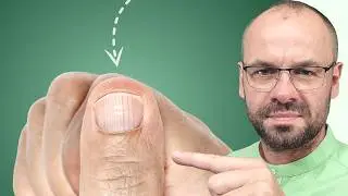Nails don't lie! Here's what they say about your health.