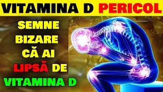 11 SEMNE BIZARE CĂ AI LIPSĂ DE VITAMINA D