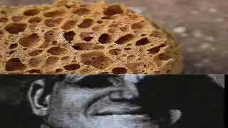 трипофобия...