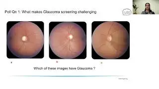 Lecture: Fundus Imaging and AI for Posterior Segment Pathology | From Validation to Implementation