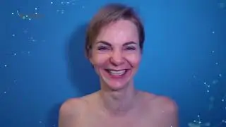 Intelligent breasts. One year post-op. 