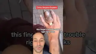 Careful with TIGHT RINGS! - Doctor Explains💍 