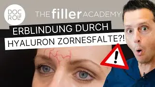 GEFAHR ERBLINDUNG HYALURON ZORNESFALTE – die Danger Zone 💣 erklärt von Dr. Rolf Bartsch