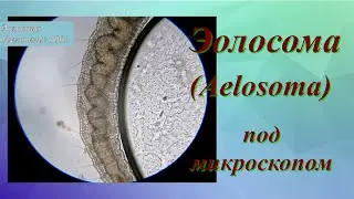 Эолосома (Aelosoma hemprichi) под микроскопом. 