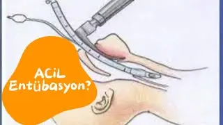 Entübasyon tepsisinde neler var?
