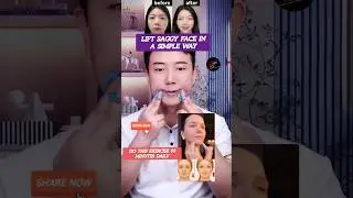 Lift Saggy Face in A Simple Way | Korean Facial Yoga 😱 